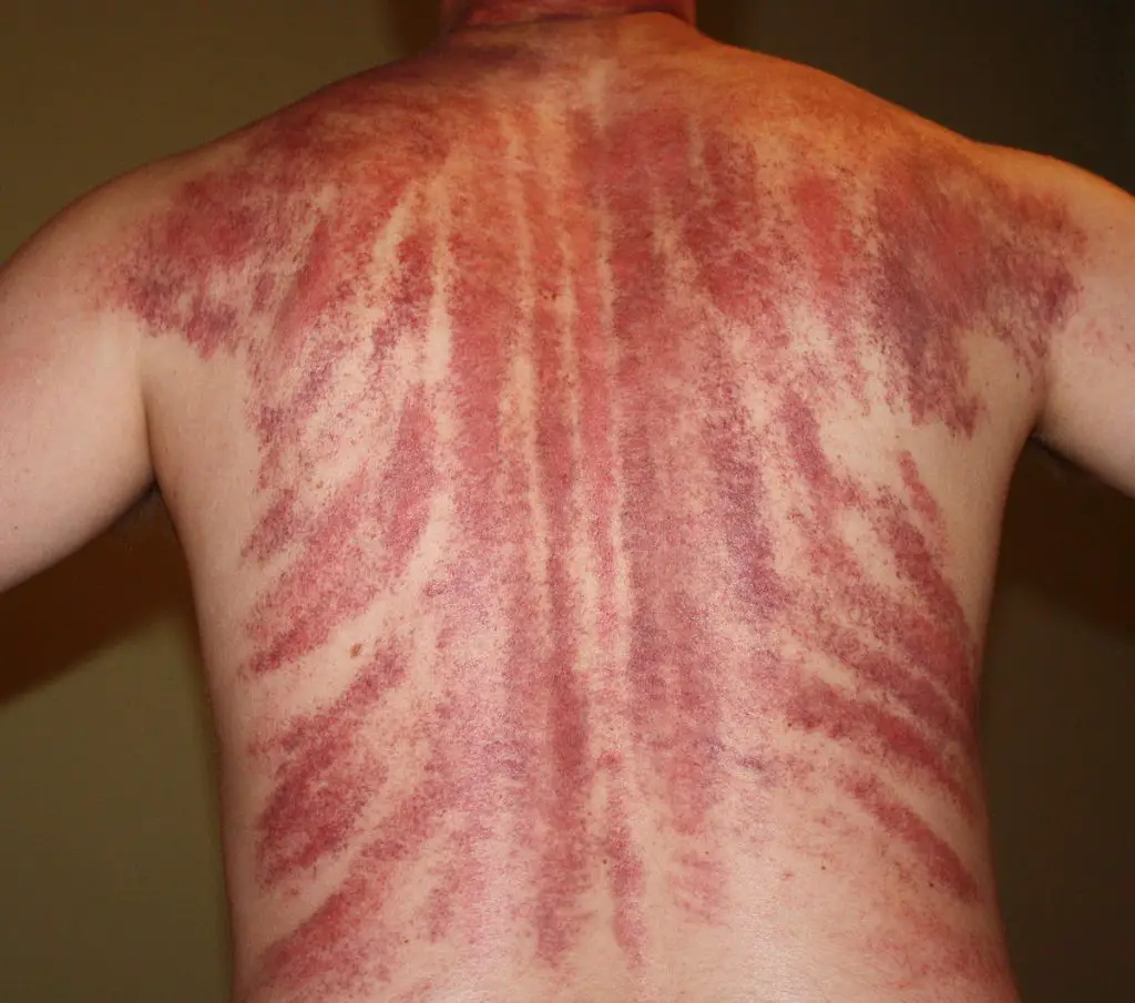 gua sha