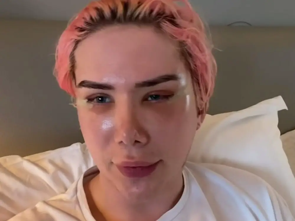 In an article about cultural appropriation and fetishization, Oli London sits in bed recovering from plastic surgery to slant their eyes.