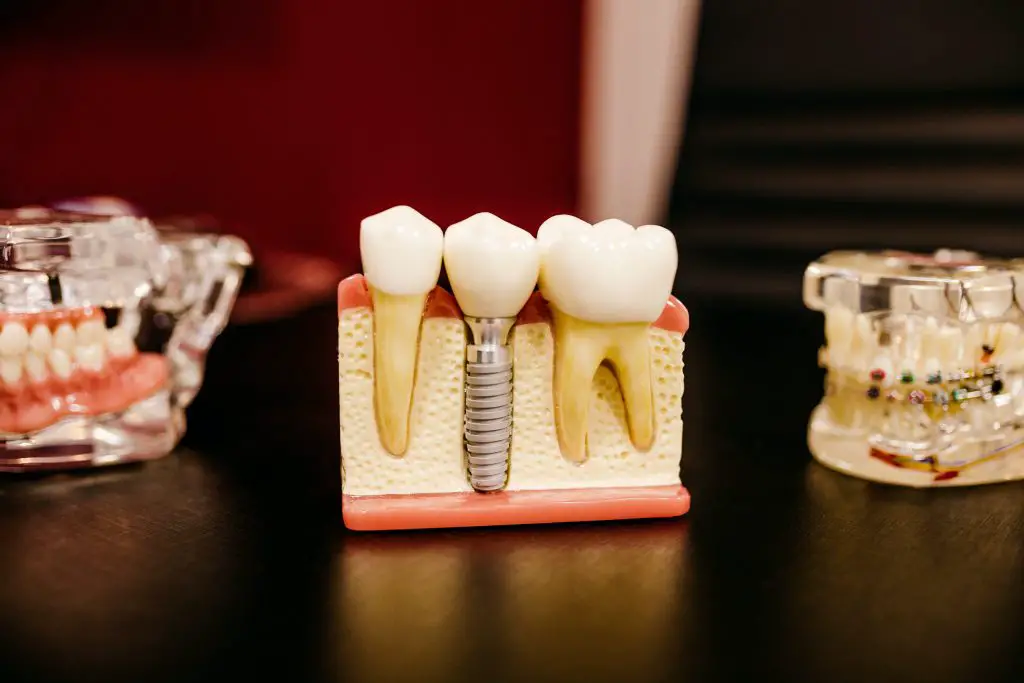 in article about oral health behaviors, models of teeth