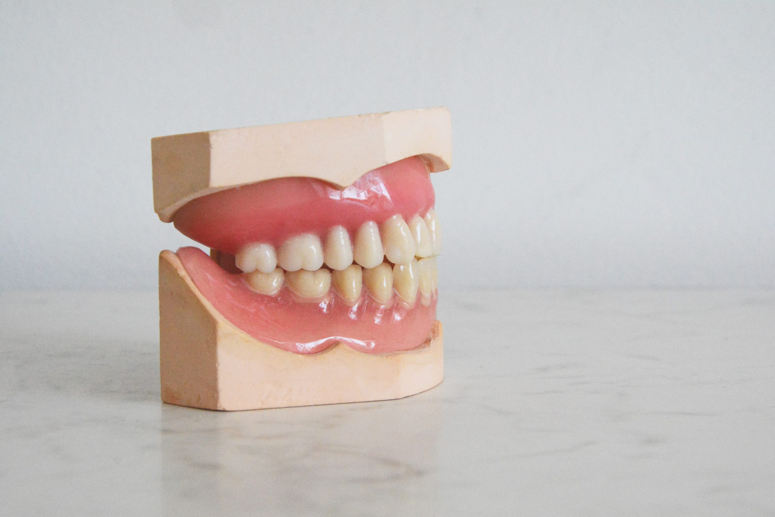 in an article about cavities, a model of human teeth