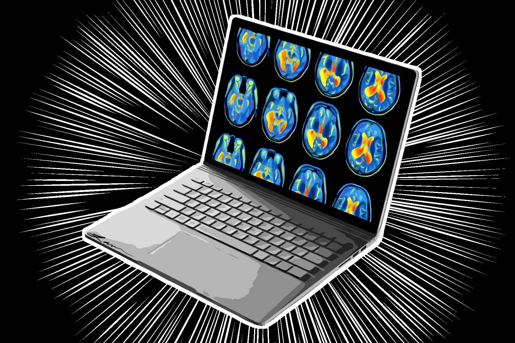 an illustration of a laptop screen and brain scans in an article about online learning